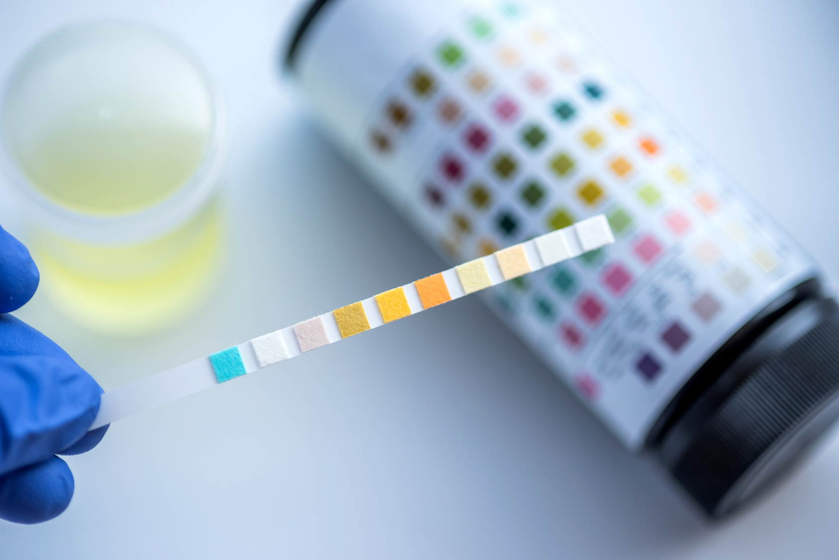 Diagnostic Et Traitement De L Infection Urinaire Chez L Enfant Pediatrie Pratique
