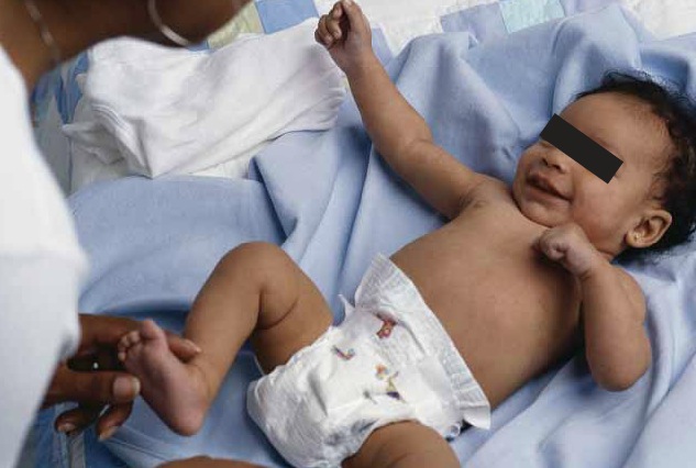 Hypotrophie Du Nourrisson Quand Et Comment Explorer Pediatrie Pratique Hypotrophie Du Nourrisson Quand Et Comment Explorer Pediatrie Pratique
