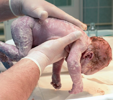 Hypotonie Axiale Isolee Patienter Ou Explorer Pediatrie Pratique