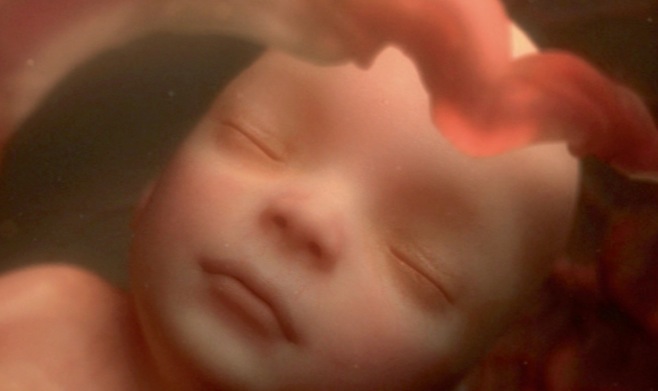 Hypotrophie Fœtale Eviter Les Complications Immediates Et Tardives Pediatrie Pratique Hypotrophie Fœtale Eviter Les Complications Immediates Et Tardives Pediatrie Pratique