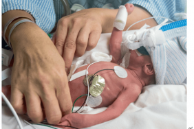 Les soins cutanés dans les unités de soins intensifs néonatales en Europe – Une enquête dans 70 unités en France et en Italie