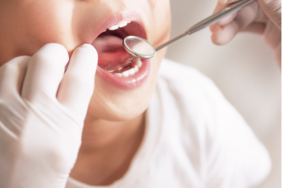 Corticosteroides Inhales Et Caries Dentaires Chez L Enfant Pediatrie Pratique Corticosteroides Inhales Et Caries Dentaires Chez L Enfant Pediatrie Pratique