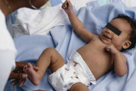 Hypotrophie Du Nourrisson Quand Et Comment Explorer Pediatrie Pratique