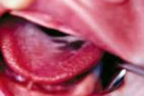 L Examen De La Bouche De L Enfant De 0 A 6 Ans Normalites Anomalies Recommandations Et Prevention Pediatrie Pratique L Examen De La Bouche De L Enfant De 0 A 6 Ans Normalites Anomalies Recommandations Et Prevention Pediatrie Pratique