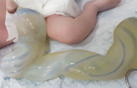 Le Nouveau Ne De Faible Poids De Naissance Prise En Charge Des 3 Premieres Annees Pediatrie Pratique Le Nouveau Ne De Faible Poids De Naissance Prise En Charge Des 3 Premieres Annees Pediatrie Pratique