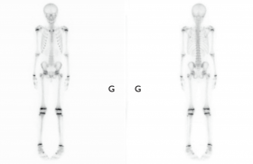 Orthorepass -Spécialiste maladies Osgood schlatter & Sever - Lors