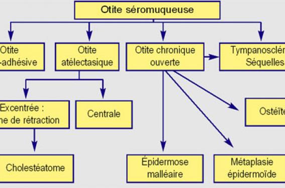 L'examen du tympan : ce qu'il faut voir - Réalités Pédiatriques